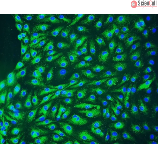 Human Lymphatic Endothelial Cells (HLEC) - Immunostaining for vWF, 200x.
