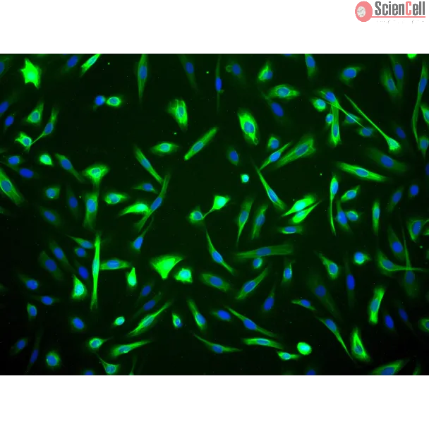 Human Mammary Epithelial Cells (HMEpiC) - Immunostaining for CK-18, 200x.
