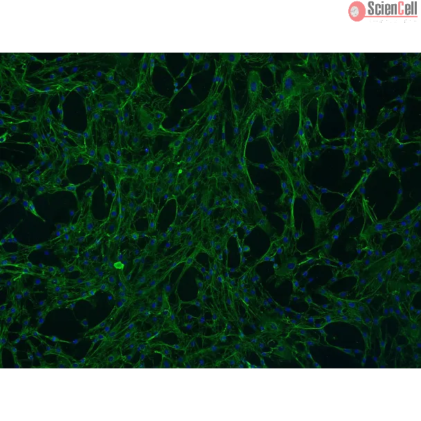 Human Mammary Fibroblasts (HMF) - Immunostaining for Fibronectin, 100x

