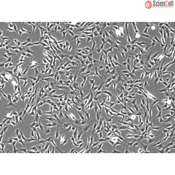 Human Middle Ear Fibroblasts (HMEF)-Phase Contrast, 100x