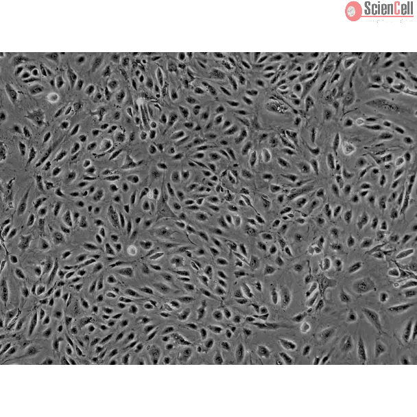 Human Myometrial Microvascular Endothelial Cells (HMMEC)-Phase Contrast, 200x.
