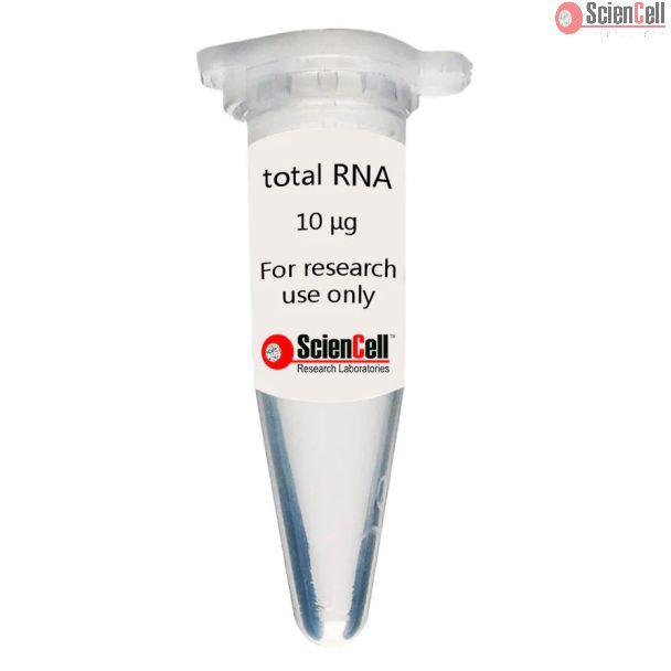 Human Neuron Total RNA