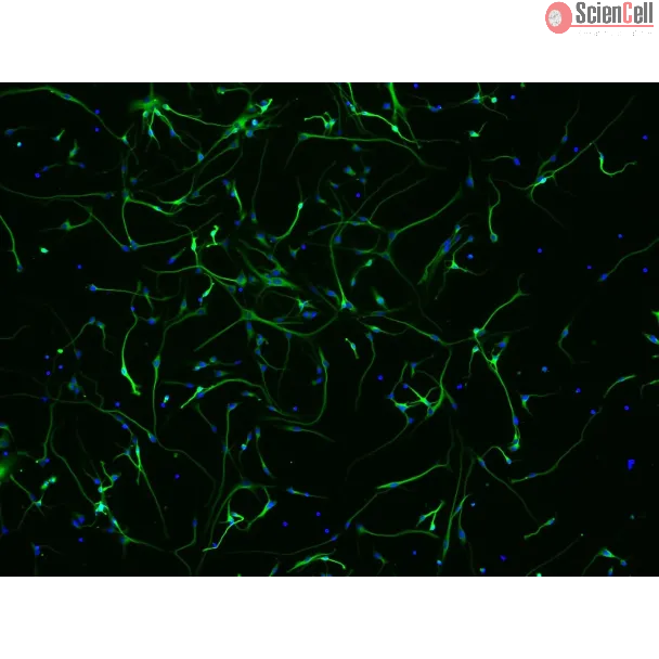 Human Neurons HN - immunostained for beta tubulin III (green), 200x

