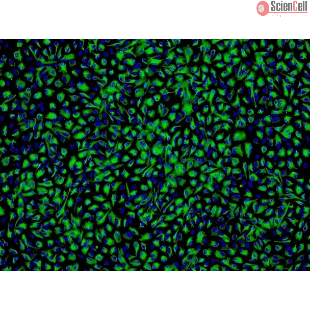 Human Non-Pigment Ciliary Epithelial Cells (HNPCEpiC) - Immunostaining for CK-18, 100x.
