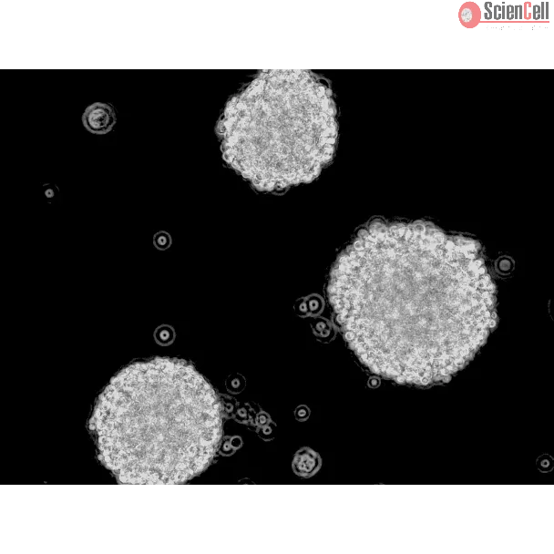 Human Oligodendrocyte Precursor Cell-oligospheres (HOPC-os) - Phase contrast, 200x.
