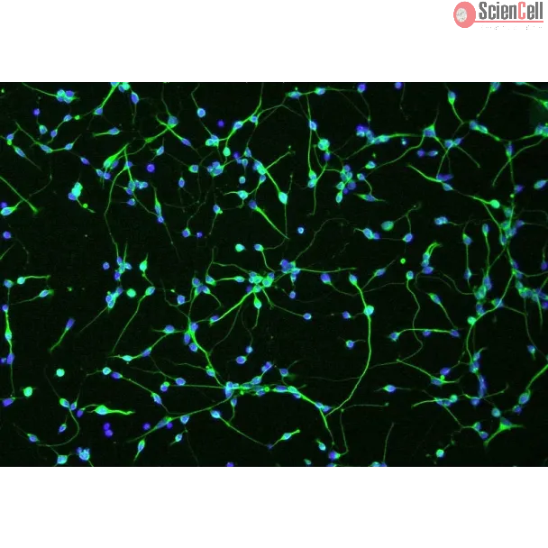 Human Oligodendrocyte Precursor Cells (HOPC) - Immunostaining for A2B5, 100x.
