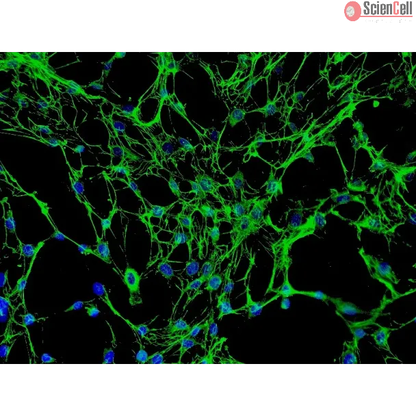 Human Osteoblasts-femoral (HO-f) - Immunostaining for Fibronectin, 200x.
