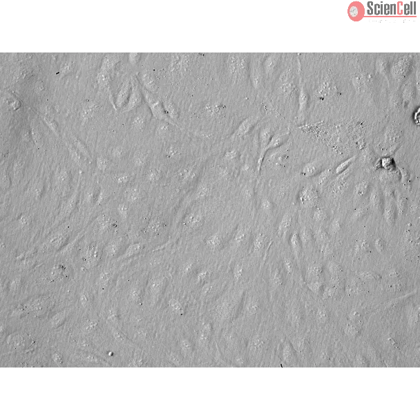 Human Pancreatic Microvascular Endothelial Cells (HPaMEC)-Relief Contrast, 200x.

