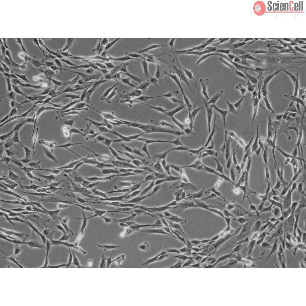 Human Pancreatic Stellate Cells (HPaSteC) - Phase contrast, 200x.
