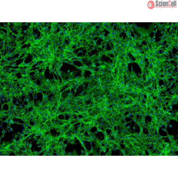 Human Pericardial Fibroblasts (HPcF) - Immunostaining for Fibronectin, 100x.
