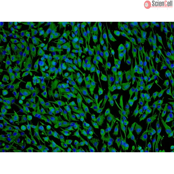 Human Perineurial Cells (HPNC) - Immunostaining for Vimentin, 100x.
