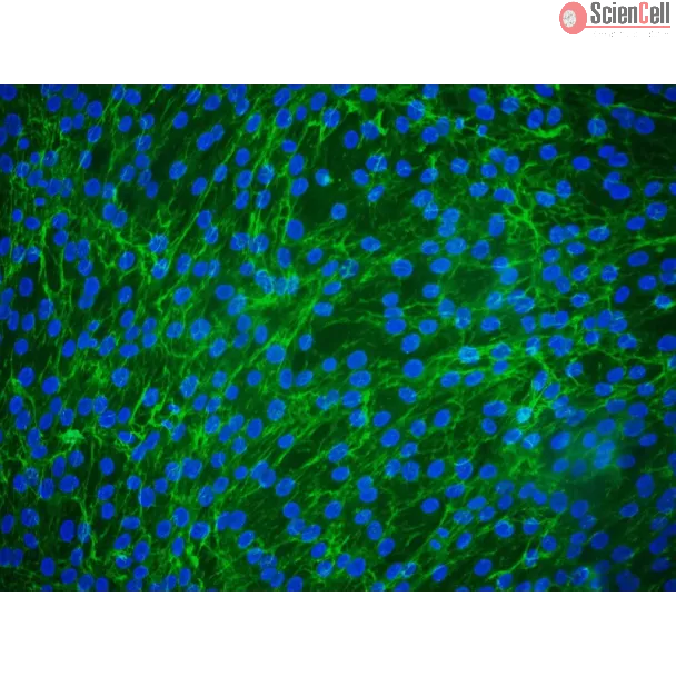 Human Peridontal Ligament Fibroblasts (HPLF) - Immunostaining for Fibronectin, 200x.
