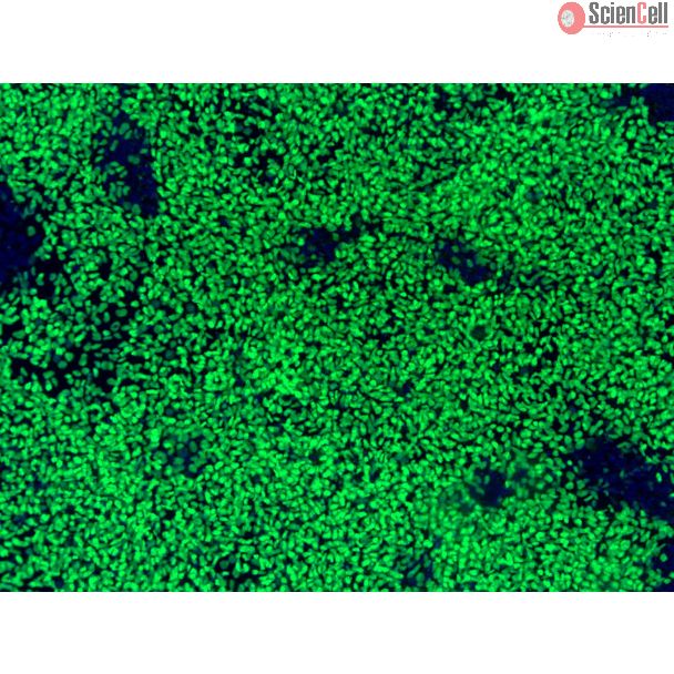 hPSC-Derived Neural Crest Cells (hPSC-NCC) - Immunostaining for SOX10, 100x