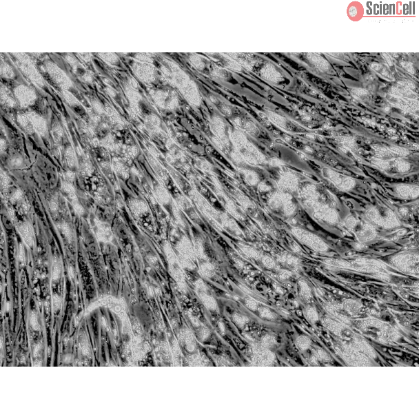 Intracellular lipid droplets are visible after differentiation, 400x.