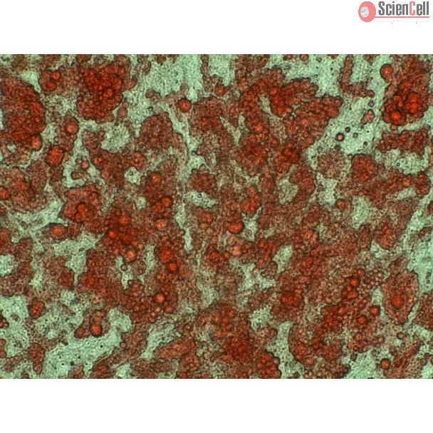 Human Preadipocytes-visceral (HPA-v) - Intracellular lipid droplets are visible after differentiation by Oil Red O staining, 400x.