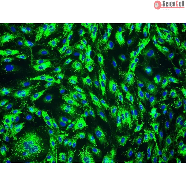 Human Prostate Microvascular Endothelial Cells (HPrMEC) - Immunostaining for vWF, 200x.
