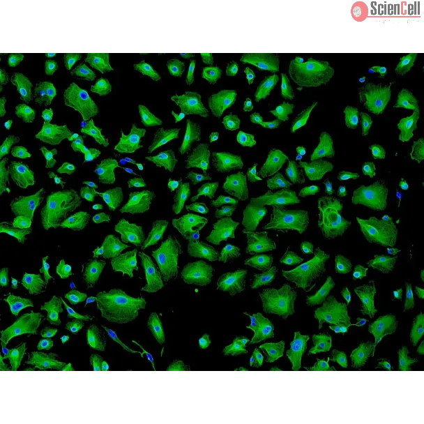 Human Pulmonary Alveolar Epithelial Cells (HPAEpiC) - Immunostaining for CK-18, 100x.
