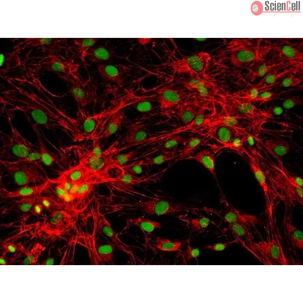 Human Pulmonary Fibroblasts-adult (HPF) - Immunostaining for Fibronectin, 200x.
