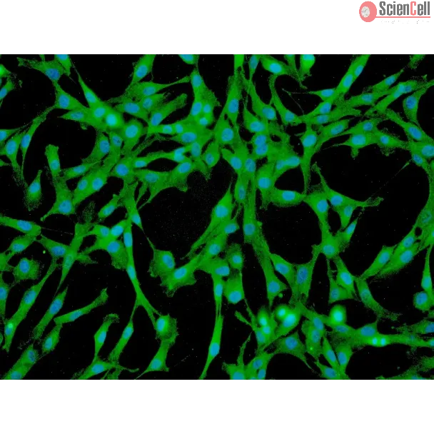 Human Pulmonary Mesenchymal Stem Cells (HPMSC) - Immunostaining for CD73, 200x.
