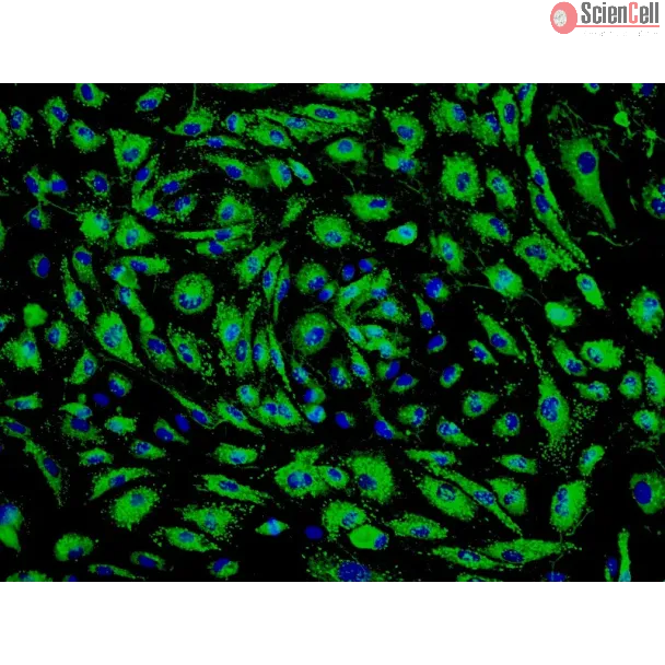 Human Pulmonary Microvascular Endothelial Cells (HPMEC) - Immunostaining for vWF, 200x.
