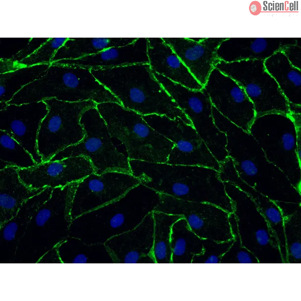 Human Rectal Microvascular Endothelial Cells (HRecMEC), Immunostaining for CD-31, 400x.

