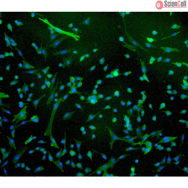 Human Rectal Smooth Muscle Cells (HRSMC) - Immunostaining for α-SMA, 100x.

