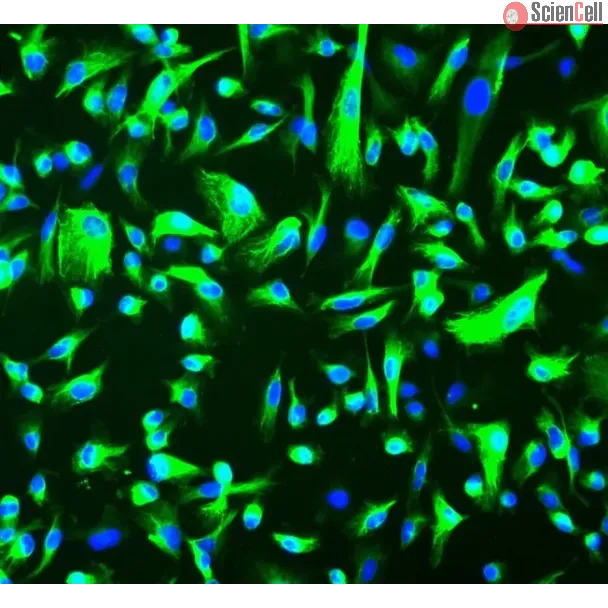 Human Renal Epithelial Cells (HREpiC) - Immunostaining for CK-18, 200x.
