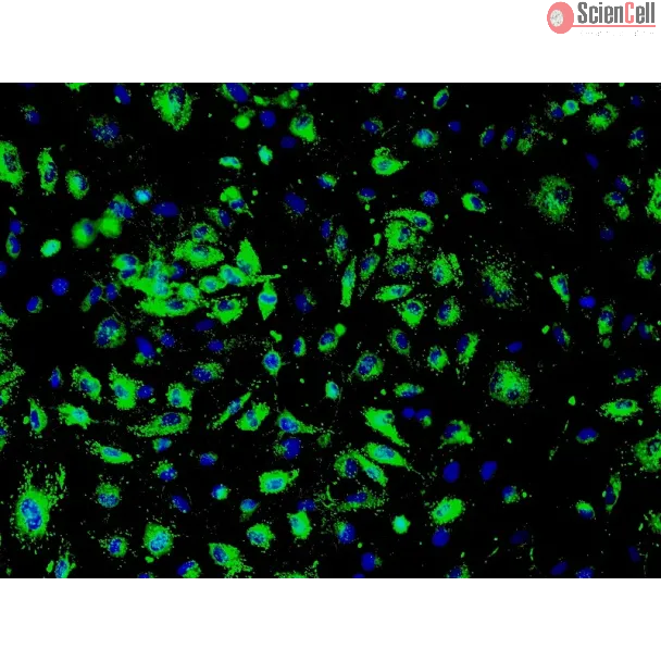 Human Renal Glomerular Endothelial Cells (HRGEC) - Immunostaining for vWF, 200x.
