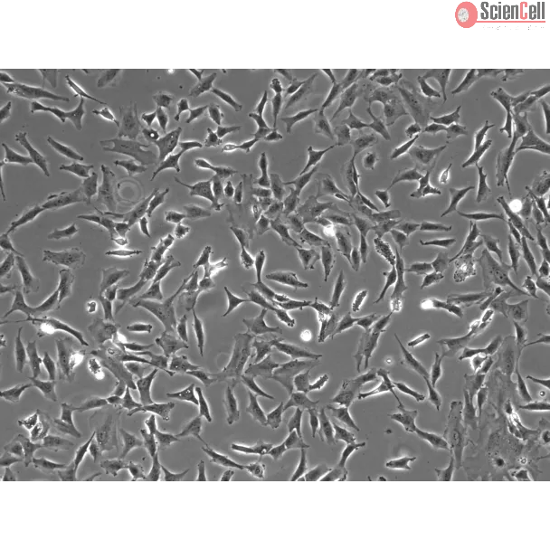 Human Retinal Astrocytes (HRA) - Phase contrast, 100x.
