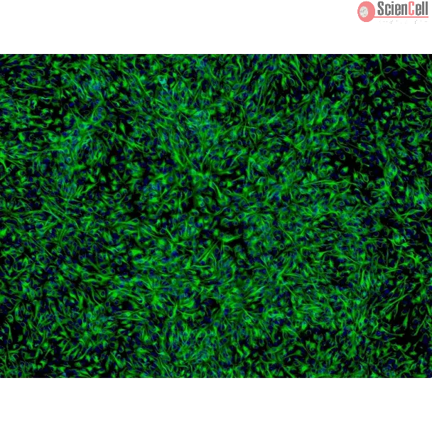 Human Retinal Pigment Epithelial Cells (HRPEpiC) - Immunostaining for CK-18, 200x.
