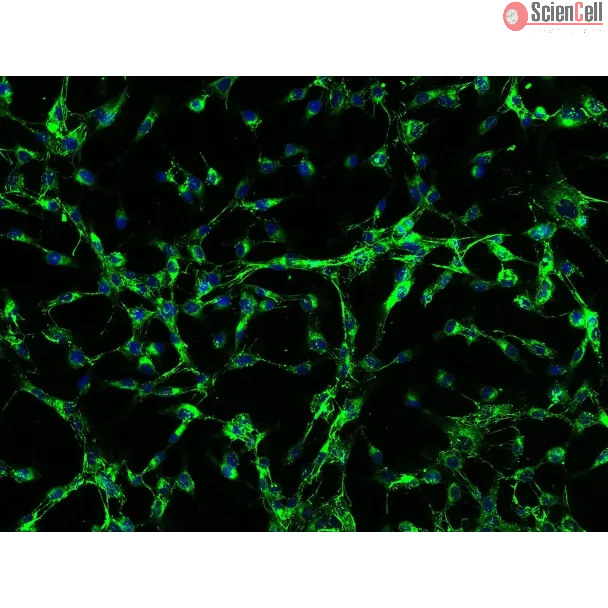 Human Scalp Fibroblasts-fetal (HScF-f) - Immunostaining for Fibronectin, 200x.
