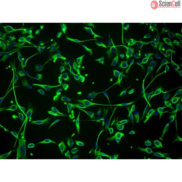 Human Schwann Cells (HSC) - Immunostaining for S100-β, 200x.
