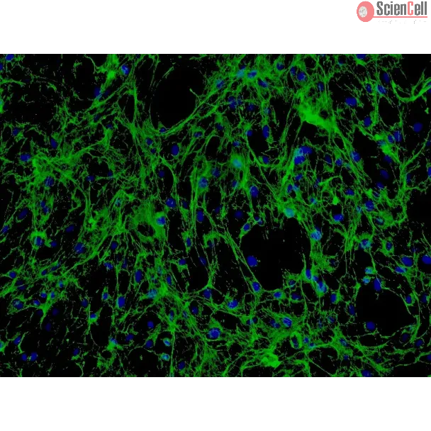 Human Seminal Vesicle Fibroblasts (HSVF) - Immunostaining for Fibronectin, 200x.
