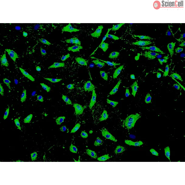 Human Seminal Vesicle Microvascular Endothelial Cells (HSVMEC) - Immunostaining for vWF, 100x.
