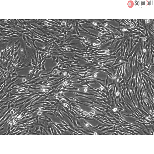Human Seminal Vesicle Smooth Muscle Cells (HSVSMC) - Phase Contrast, 100X
