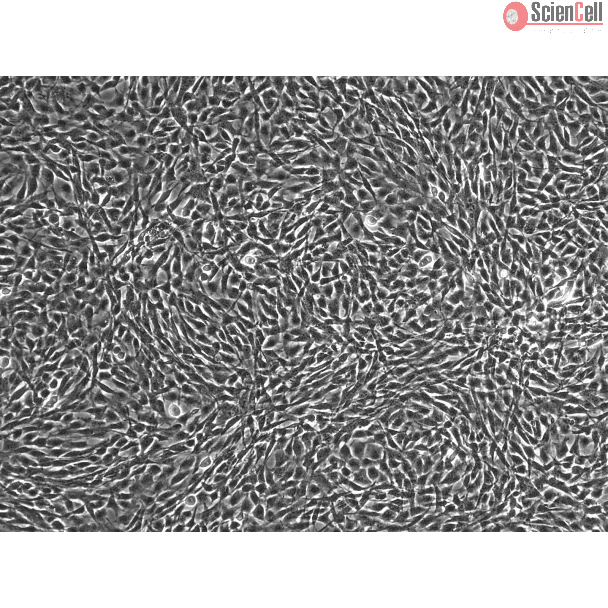 HUMAN SKELETAL MUSCLE MYOBLASTS (HSkMM)- phase contrast 100X
