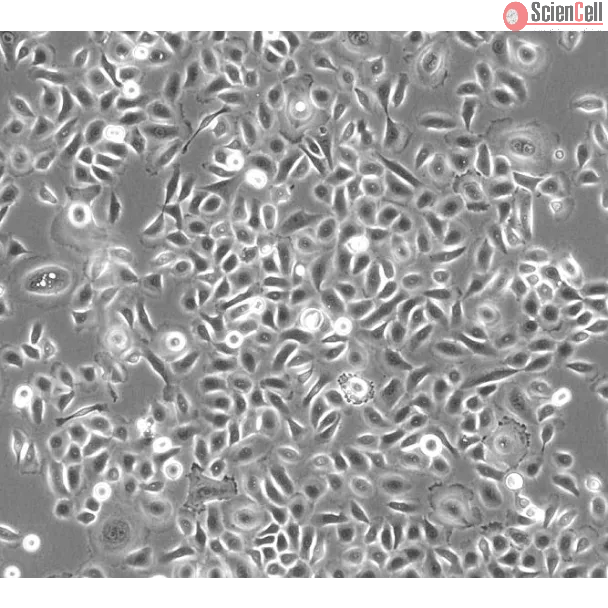 Human Small Airway Epithelial Cells (HSAEpiC) - Phase contrast 100x