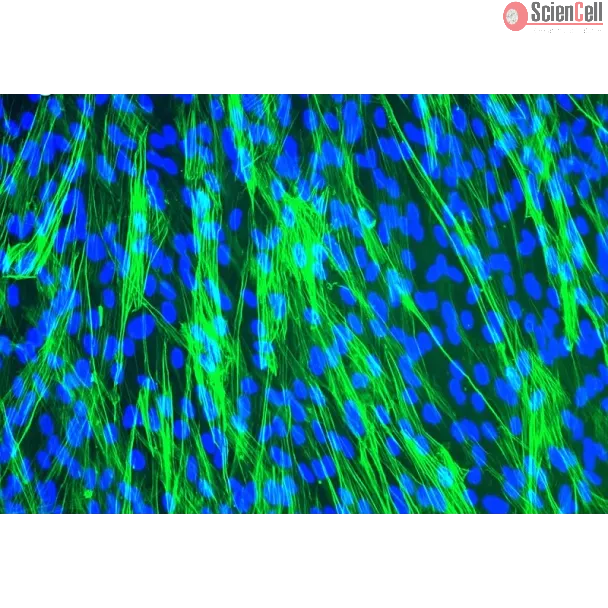 Human Tracheal Smooth Muscle Cells (HTSMC) - Immunostaining for .
