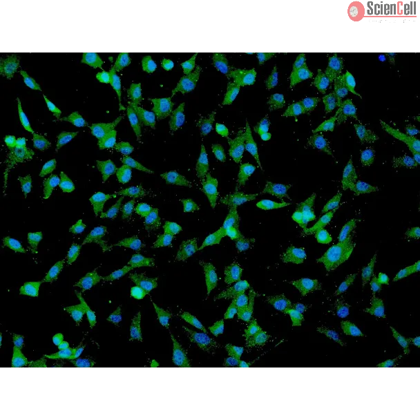Human Umbilical Mesenchymal Stem Cells (HUMSC) - Immunostaining for CD73, 200x.
