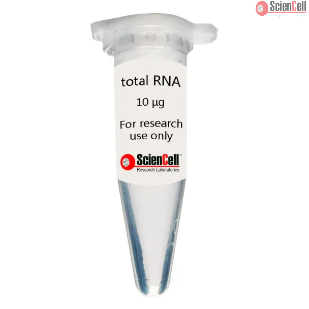 Human Vertebral Mesenchymal Stem Cell Total RNA