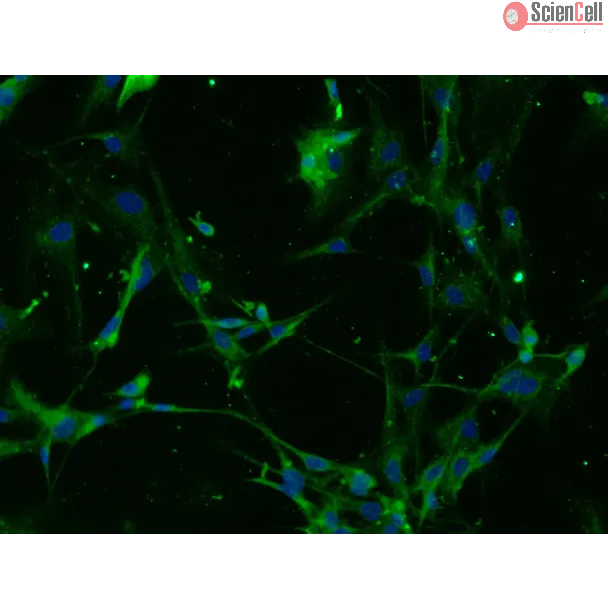 Mouse Astrocytes-adult (MA-a) – Immunostaining for GFAP, 200x.
