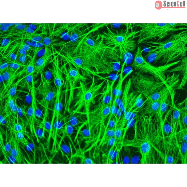 Mouse Astrocytes (MA) - Immunostaining for GFAP, 200x.
