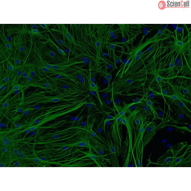 Mouse Astrocytes-hippocampal (MA-h) - Immunostaining for GFAP, 200x.
