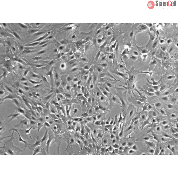 Mouse Astrocytes-hippocampal (MA-h) - Phase contrast, 100x.
