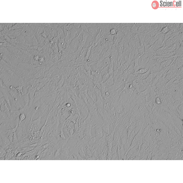 Mouse Embryonic Fibroblasts (MEF) - Relief Contrast, 200X.
