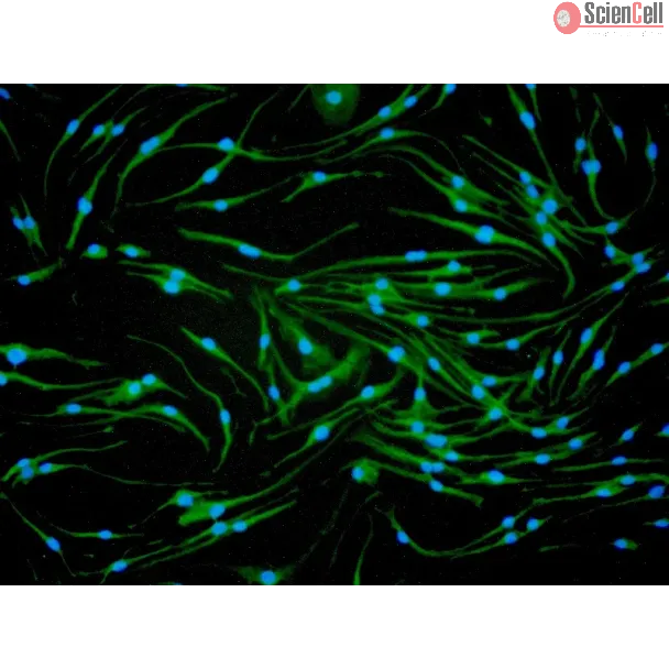 Mouse Macrophages-bone marrow (MMa-bm) - Immunostaining for CD11b, 200x.
