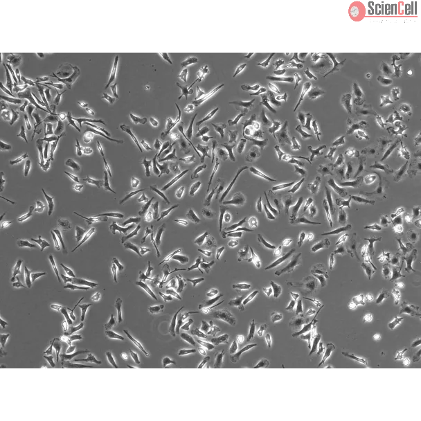 Phase Contrast Caption: Mouse Microglia (MM)- Phase Contrast, 100x
