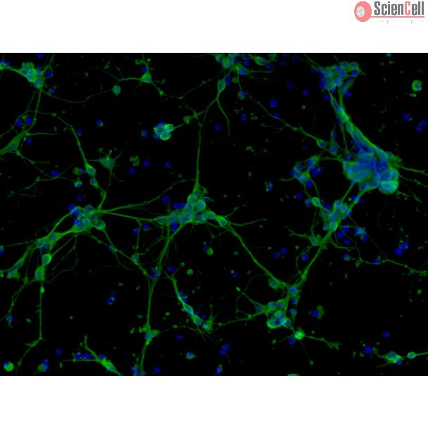 Mouse Neurons-forebrain (MN-fb)-Immunostaining for b-tubulin III, 200X