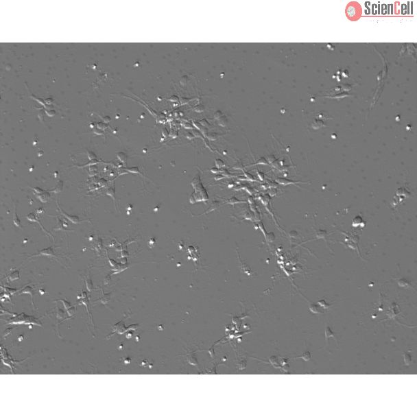 Mouse Neurons-midbrain (MN-mb)-Phase Contrast, 100X