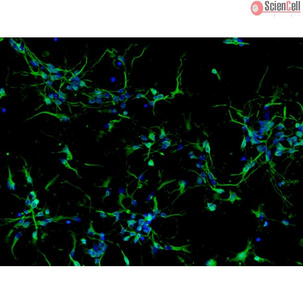 Mouse Neurons-midbrain (MN-mb)-Immunostaining for β-tubulin III, 200X